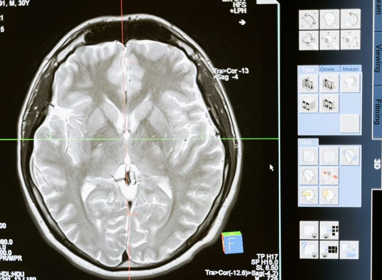 Axial MRI scan of a human brain showing cerebral cortex, white matter, and ventricles, with red and green reference lines and interface annotations.