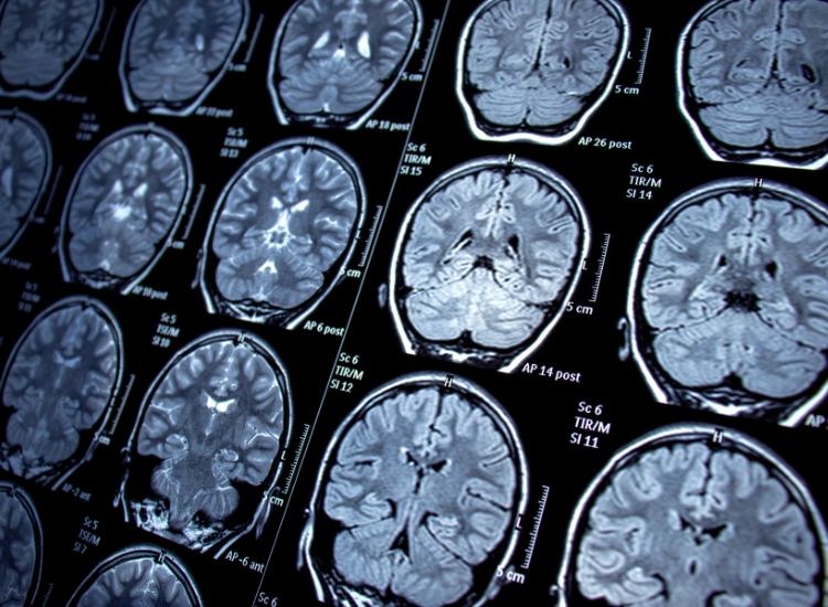 Grid of brain MRI slices showing cross-sectional views with labeled imaging sequences and measurement scales.